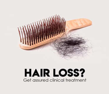 Hair Loss Treatment