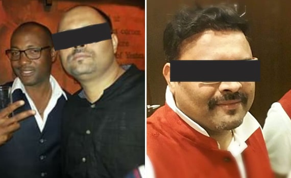 Before & After Hair Transplantation - Patient 10