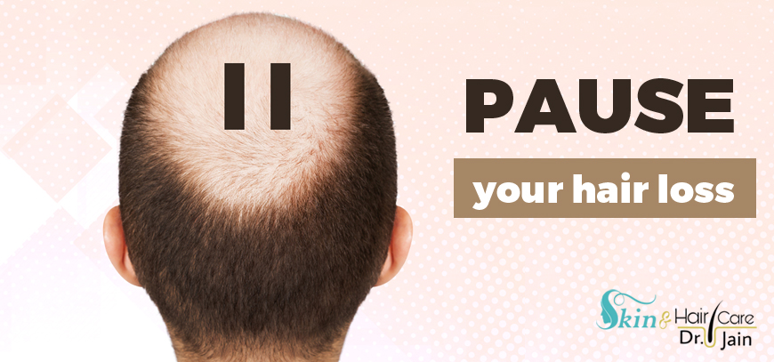 Pause your hair loss